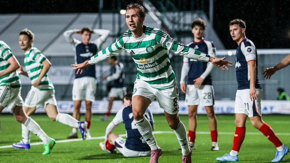 Celtic Game Today: Scottish Champions Eye Next Challenge After Cup Victory