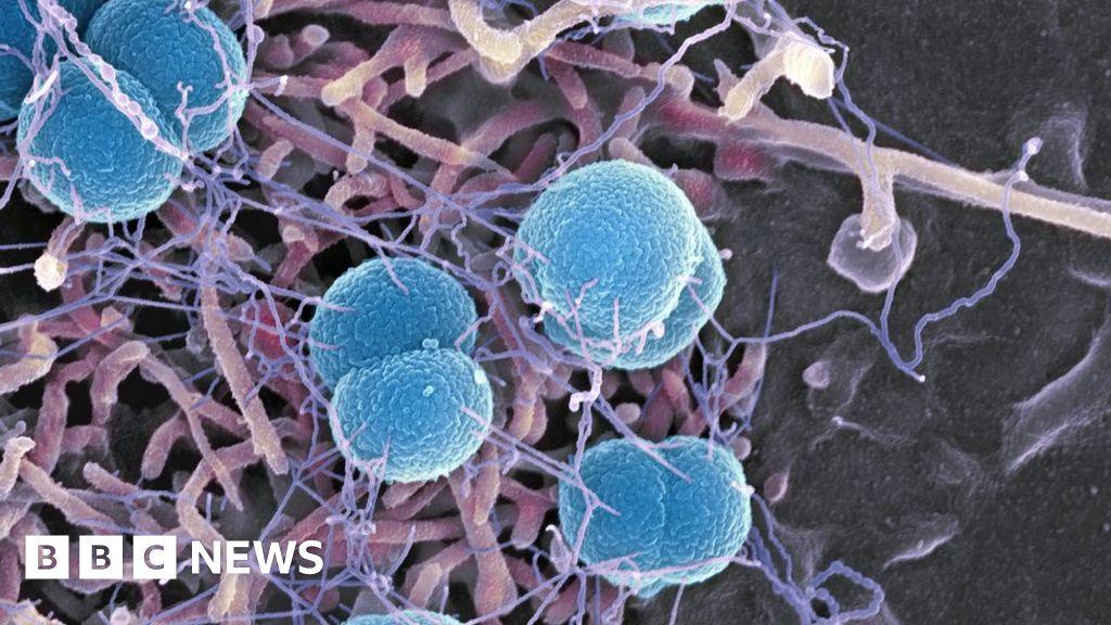 Bacterial meningitis outbreak in Kent: public health response and guidance